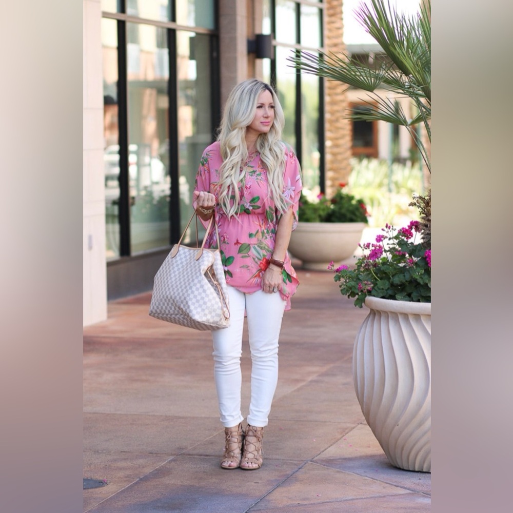 Express Tropical Mini Tunic Dress - Picture 13 of 15